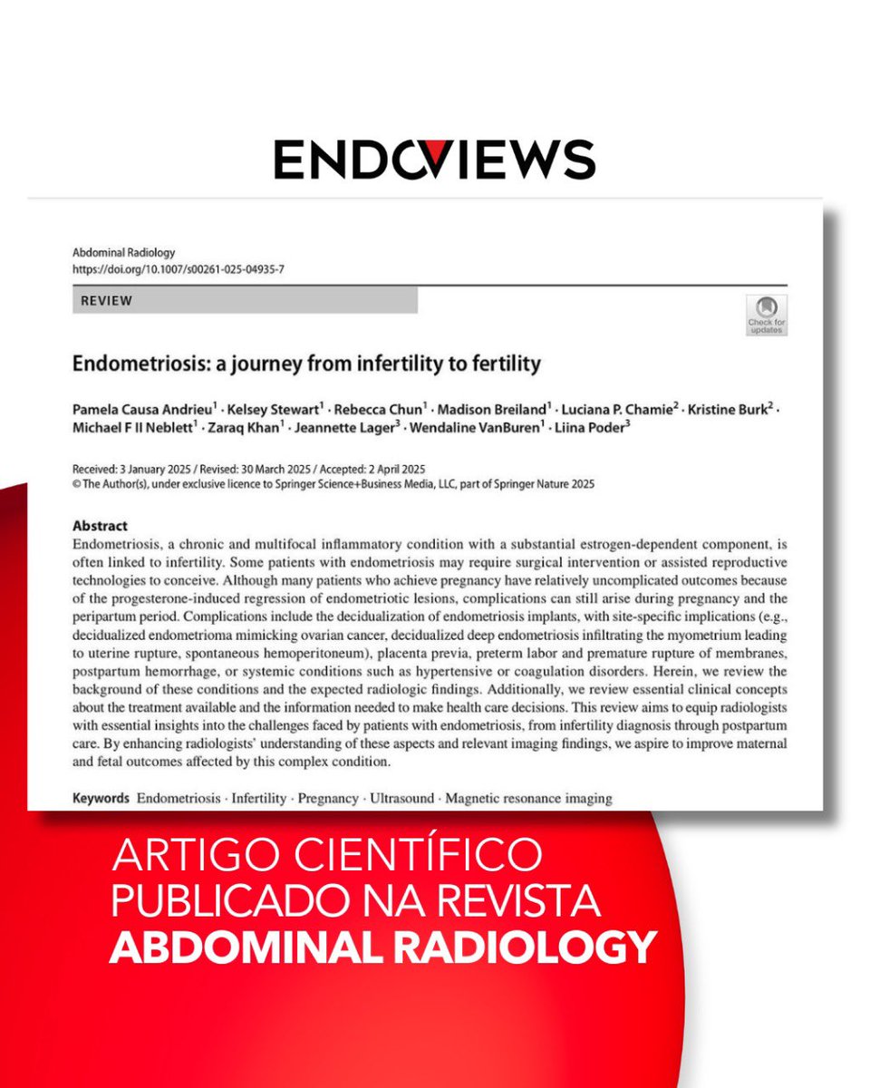 endoviews's tweet image. Compartilhamos com vocês mais um trabalho importante sobre imagem da endometriose, desenvolvido pelo DFP da Society of Abdominal Radiology e liderado pelas especialistas @lp_pam_ e @lpoder.