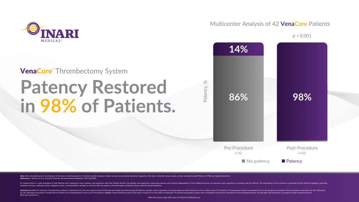 In a multicenter analysis of 42 patients, the #VenaCore Thrombectomy System restored vessel patency in 98% of patients — a strong testament to its clinical performance.

When it comes to addressing advanced venous occlusions, VenaCore is delivering patient outcomes that matter.