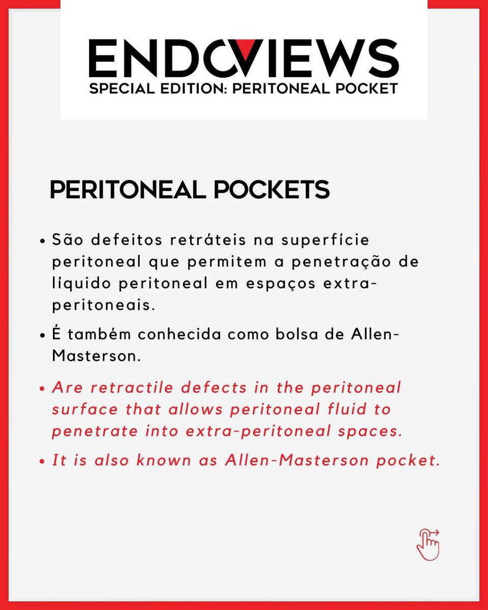 endoviews's tweet image. Com satisfação apresentamos a Special Edition: Peritoneal Pockets. Também chamadas de bolsas de Allen-Masterson, são defeitos no peritônio que permitem a passagem de líquido para espaços extraperitoneais. Um achado sutil, mas relevante na imagem da endometriose.
Acompanhem!