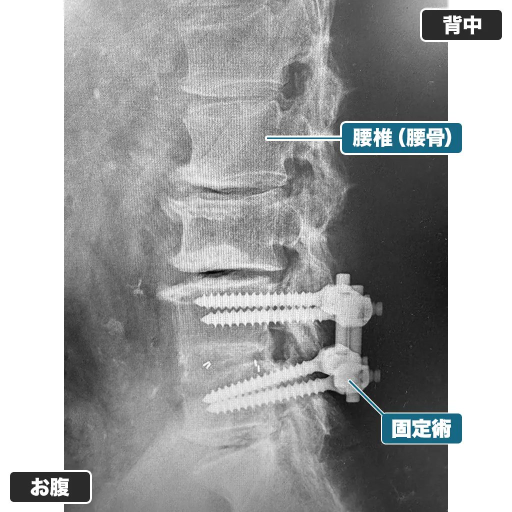 野中腰痛クリニック (@Nlclinic_0722) / X
