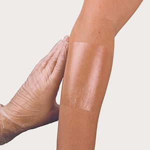 Flexus Resources (Pty) Ltd (@flexusresources) on Twitter photo Patients undergoing radiation treatment for breast cancer are at risk of developing painful skin reactions. To help PREVENT these reactions, MEPITEL FILM can be used prophylactically in order to decrease the severity of radiotherapy skin reactions ~ wecare@flexusresources.co.za Patients undergoing radiation treatment for breast cancer are at risk of developing painful skin reactions. To help PREVENT these reactions, MEPITEL FILM can be used prophylactically in order to decrease the severity of radiotherapy skin reactions ~ wecare@flexusresources.co.za
