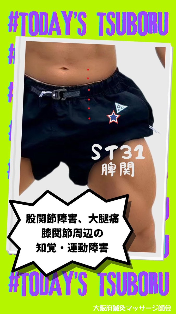 osmk_osaka's tweet photo. 今日のつぼる君 #脾関 #ST31
#大阪府鍼灸マッサージ師会
#大阪府東洋療法協同組合
#鍼灸マッサージちゃんねる
#今日のつぼる君
#鍼灸好きな人とつながりたい
#鍼灸 #マッサージ
#東洋医学 #ツボ
#健康 #未病
#セルフケア
#acupuncture https://t.co/iIcrSw9hCC