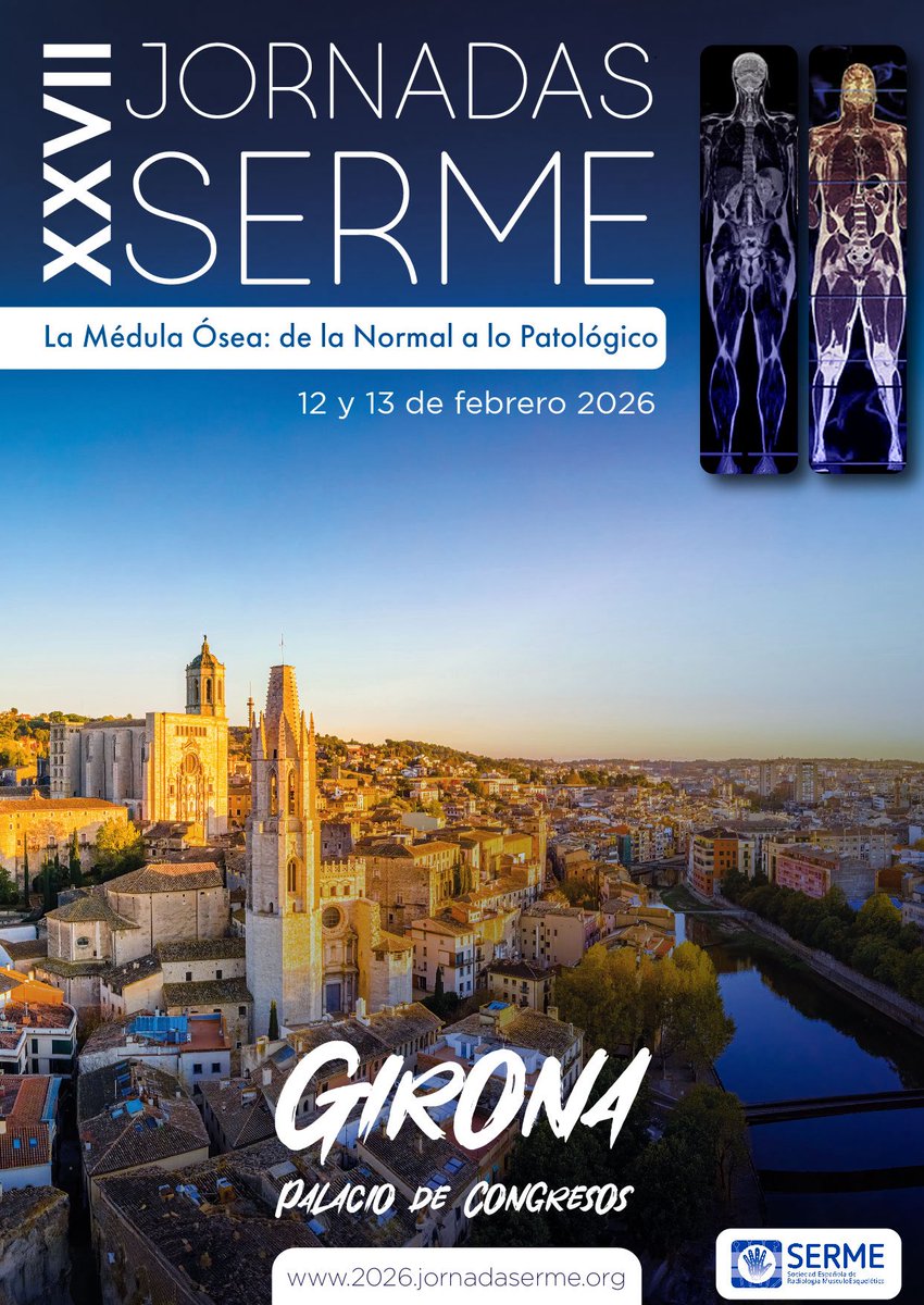 Reserva la fecha! 📅
Las XVII Jornadas de <a href="/MskSerme/">SERME</a> serán el 12-13 feb 2026 en Girona 🏛️
Tema: “La médula ósea: de lo normal a lo patológico” 🦴
Expert@s, casos interactivos y lo último en imagen musculoesquelética 🧠🖥️
#Radiología #SERME2026 #Girona