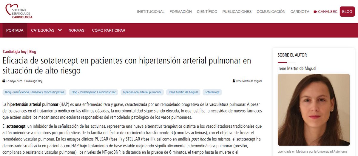 Soc Esp Cardiología (@secardiologia) on Twitter photo .<a href="/IreneMartndeMi1/">Irene Martín de Miguel</a>: “En el ensayo ZENITH, en hipertensión arterial pulmonar de alto riesgo, el sotatercept resultó en un menor riesgo del objetivo de muerte por cualquier causa, trasplante pulmonar o ingreso frente a placebo". #BlogSEC <a href="/JovenesSec/">JóvenesSEC</a> ow.ly/VHRk50VRysa .<a href="/IreneMartndeMi1/">Irene Martín de Miguel</a>: “En el ensayo ZENITH, en hipertensión arterial pulmonar de alto riesgo, el sotatercept resultó en un menor riesgo del objetivo de muerte por cualquier causa, trasplante pulmonar o ingreso frente a placebo". #BlogSEC <a href="/JovenesSec/">JóvenesSEC</a> ow.ly/VHRk50VRysa