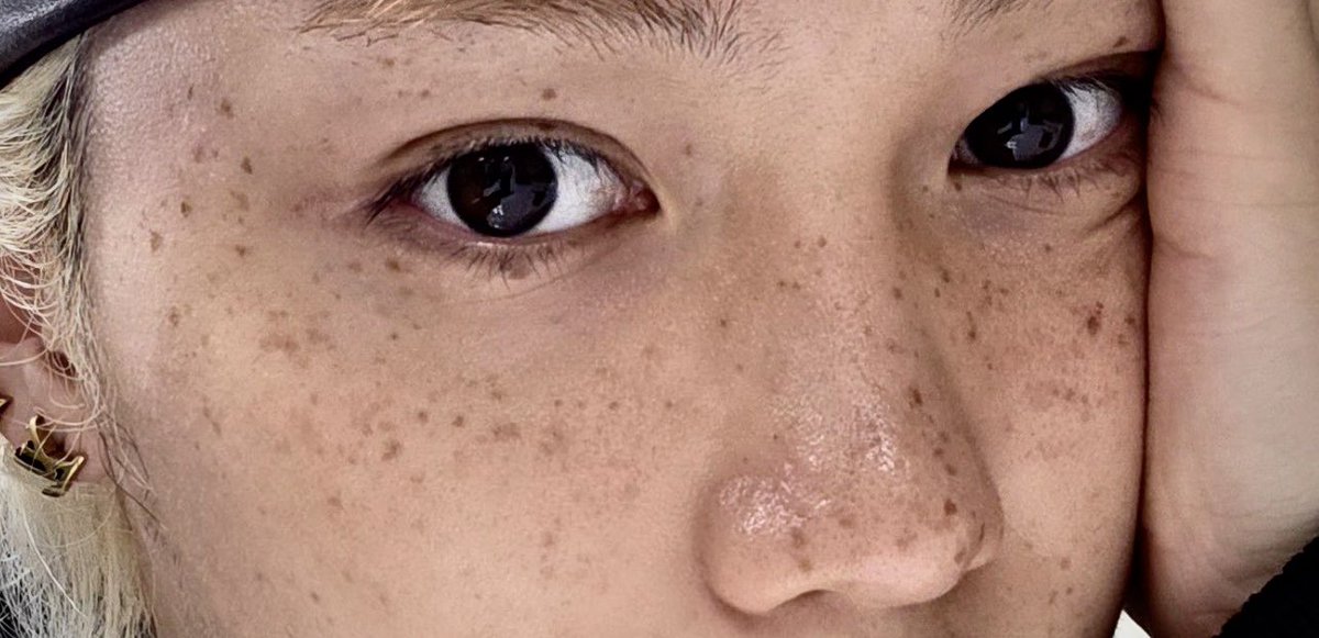 felix’s freckles are so pretty