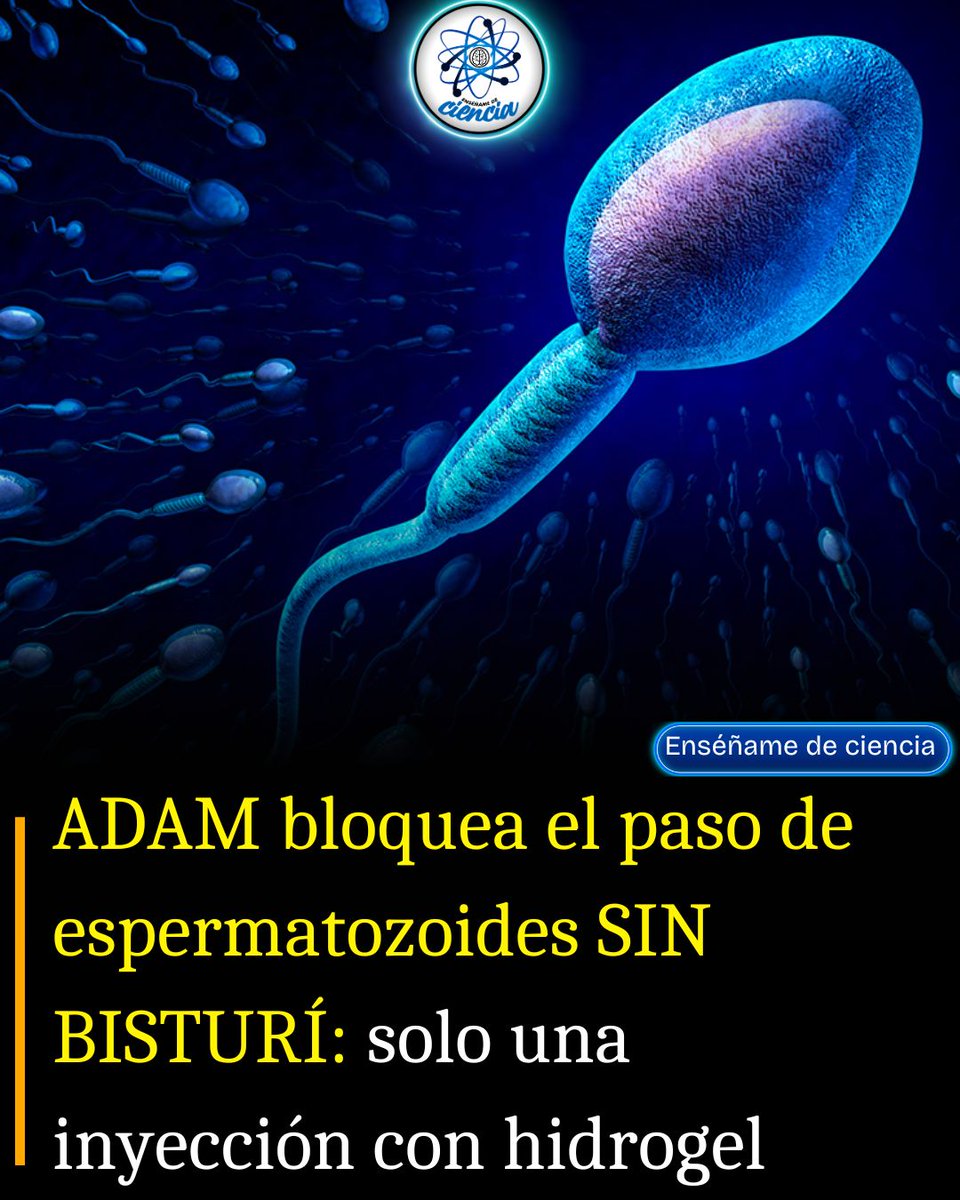 EnsedeCiencia's tweet photo. ADAM, el nuevo método anticonceptivo masculino que ofrece una alternativa a la vasectomía.

Surge una eficaz y cómoda alternativa a la vasectomía. Se trata del método anticonceptivo ADAM, el cual es un gel que se inyecta en los conductos deferentes e impide que los espermatozoides se transporten.

Esto genera azoospermia, es decir, producción de semen sin espermatozoides. Es no hormonal, reversible y mínimamente invasivo, además de que el proceso para aplicarlo dura menos de 10 minutos.

Ya se ha presentado la fase I del ensayo de este gel, el cual demostró que dos de los participantes alcanzaron la azoospermia a los 24 meses sin presentar efectos adversos graves.

Otra característica que lo distingue de la vasectomía es que ADAM se disuelve pasado el tiempo y permite recuperar la fertilidad.

Aunque es muy prometedor, todavía no se ha aprobado su comercialización, pues se está preparando el ensayo clínico en Fase II que se prevé inicie en el tercer trimestre de 2025.