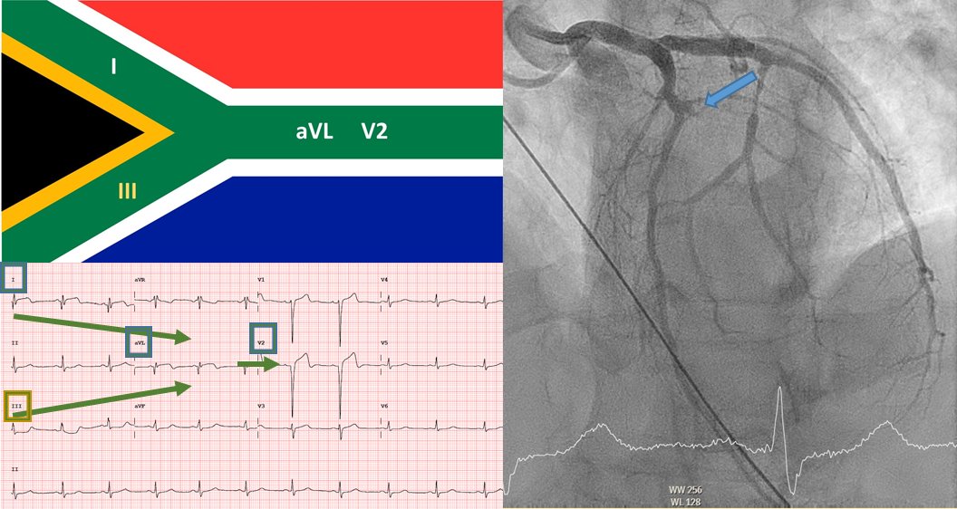 Felipe Díez del Hoyo tweet media