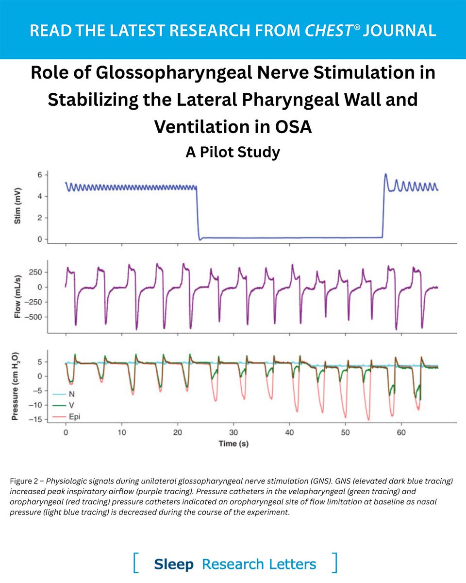CHEST® Journal (@journal_chest) on Twitter photo A #CHESTSleep research letter describes a novel technique for percutaneous glossopharyngeal nerve stimulation to investigate Guilleminault’s tent hypothesis.
Read the full article in the May issue of the journal CHEST®: hubs.la/Q03p8J1-0
#MedEd #JournalCHEST #SleepMed #OSA A #CHESTSleep research letter describes a novel technique for percutaneous glossopharyngeal nerve stimulation to investigate Guilleminault’s tent hypothesis.
Read the full article in the May issue of the journal CHEST®: hubs.la/Q03p8J1-0
#MedEd #JournalCHEST #SleepMed #OSA