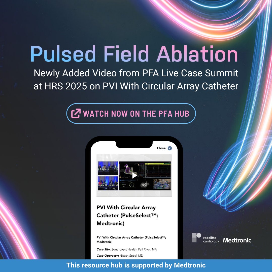 radcliffeCARDIO's tweet image. Dr Nitesh Sood demonstrates his approach to #PVI using the PulseSelect™ catheter by Medtronic in this live case 👉 ow.ly/Rf8y50VZs6z

👤 Patient: 67-year-old male with recurrent paroxysmal AF despite Sotalol. Normal atrial voltage and left atrial volume.
⏰ 20 minutes