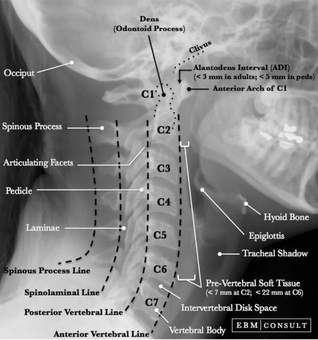 Cervical Spine. 

instagram.com/p/DJzIxCGsnmD/