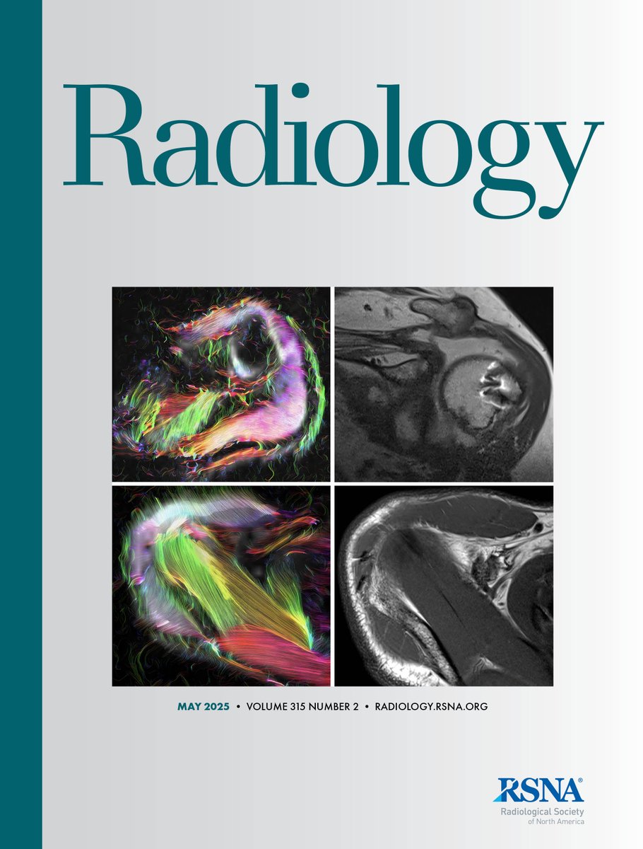 @RadiologyEditor (@radiologyeditor) on Twitter photo The full May issue of #Radiology is now online! The cover features images from the article by <a href="/FeuerriegelG/">Georg Feuerriegel</a> et al.
🩻 Explore the issue here:
pubs.rsna.org/toc/radiology/… The full May issue of #Radiology is now online! The cover features images from the article by <a href="/FeuerriegelG/">Georg Feuerriegel</a> et al.
🩻 Explore the issue here:
pubs.rsna.org/toc/radiology/…