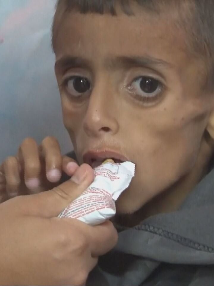 carnecrudaradio's tweet photo. Las imágenes que deberían horrorizar y avergonzar al mundo. 

Ha vuelto a ocurrir y el mundo ha vuelto a fallar. 

El genocidio en Gaza es un límite que volvemos a traspasar hacia un abismo en el que caerán las democracias por no haber hecho nada para evitarlo. https://t.co/fEZvXvFFE8