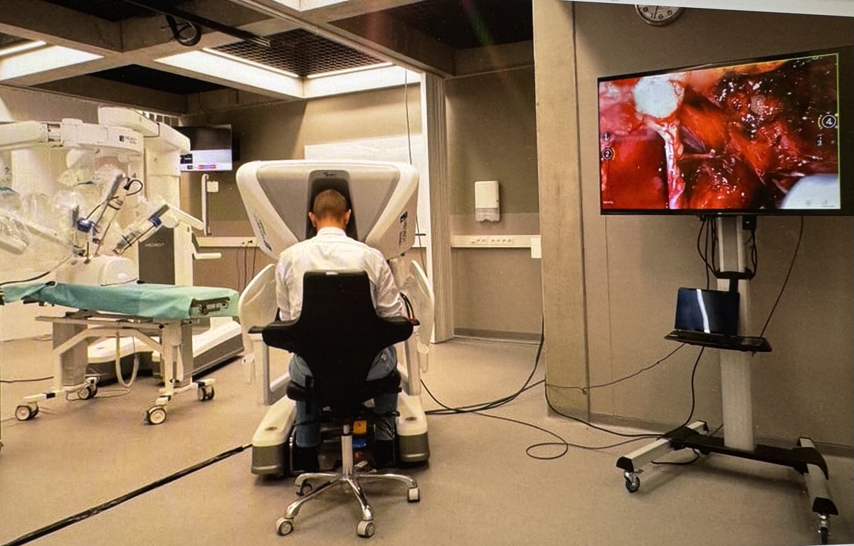 geert de naeyer (@gdnaeyer) on Twitter photo Honoured&proud having🍀 performed Europe’s 🇪🇺First Telesurgery 📡Robotic prostatectomy @AZORG From <a href="/orsiacademy/">Orsi Academy</a> with Toumai Tele-Robotic Surgical System 🤖by <a href="/MicroPort/">MicroPort</a>. Incredible latency: only 2️⃣0️⃣ msec 😱!! Thanks <a href="/alexmottrie/">Alex Mottrie</a> for back-up! Honoured&proud having🍀 performed Europe’s 🇪🇺First Telesurgery 📡Robotic prostatectomy @AZORG From <a href="/orsiacademy/">Orsi Academy</a> with Toumai Tele-Robotic Surgical System 🤖by <a href="/MicroPort/">MicroPort</a>. Incredible latency: only 2️⃣0️⃣ msec 😱!! Thanks <a href="/alexmottrie/">Alex Mottrie</a> for back-up!