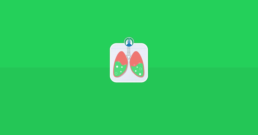 RespiratoryZone's tweet image. Cystic fibrosis is a genetic disorder that primarily affects the respiratory and digestive systems. bit.ly/3H2inzk