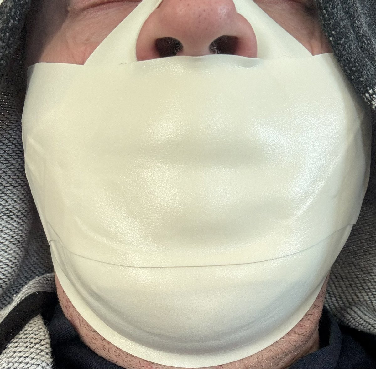 EvolutionarySub's tweet image. Having some fun playing around with my favourite type of gag today!

Microfoam tape, works well with stuffing or holding a ball gag in place!

Nothing like the mindfuck of an inescapable gag!