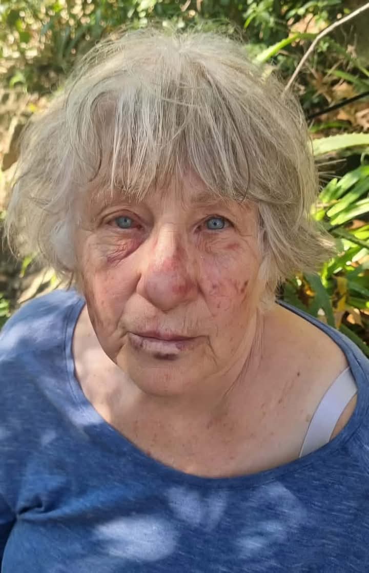 Stop white Genocide tweet media