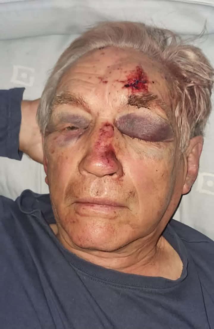 Stop white Genocide tweet media