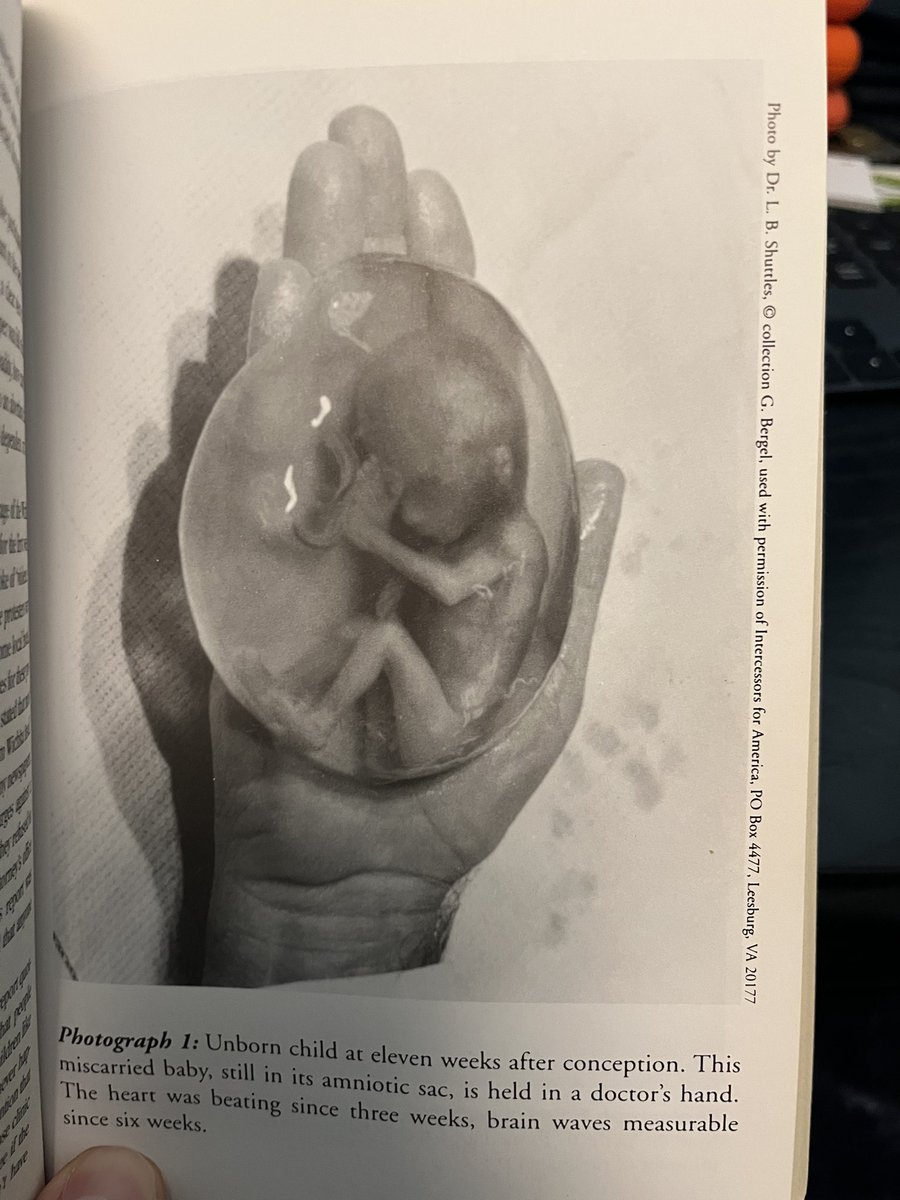This is a baby 11 weeks after conception.

Human life is miraculous.
