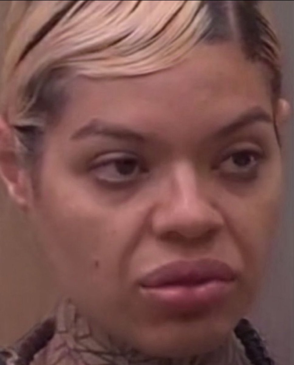 Tuvo que envidiarle a Karina la ciencia médica por qué a ella no le favoreció  #LaCasaDelLosFamosoCol