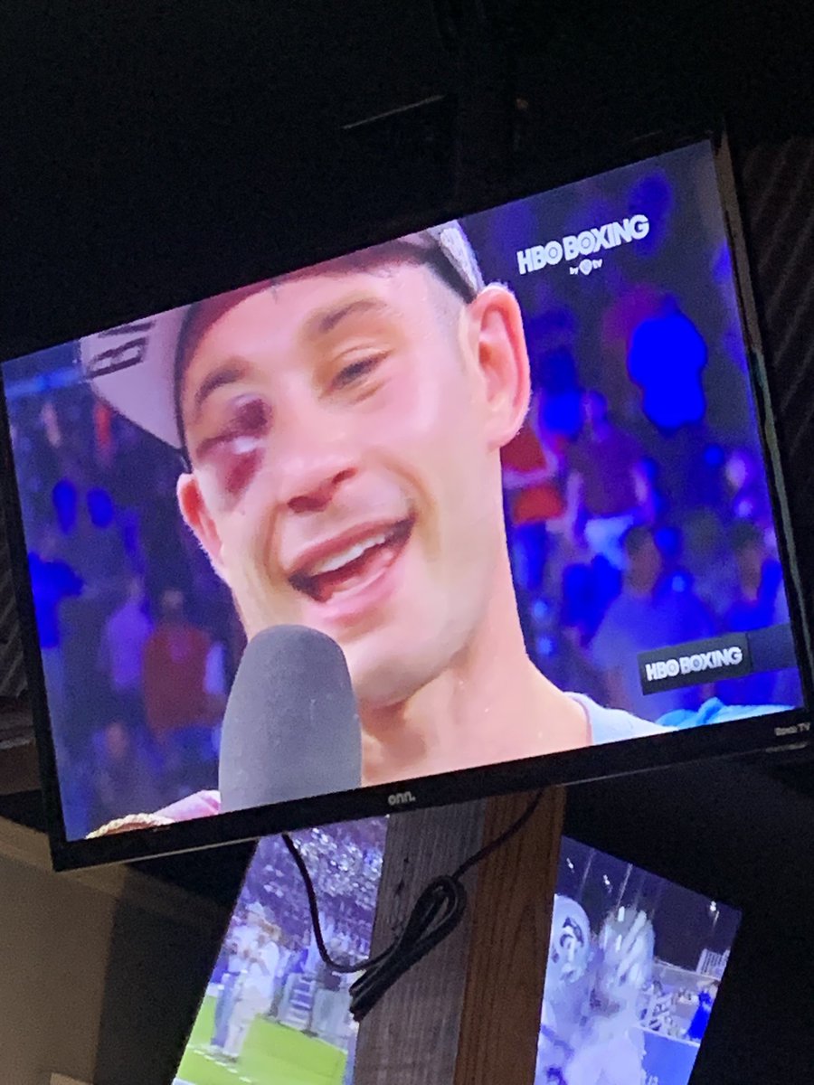 OldNewsCS's tweet image. Perhaps this guy should go to the hospital instead of doing this interview?! #Boxing #hboboxing