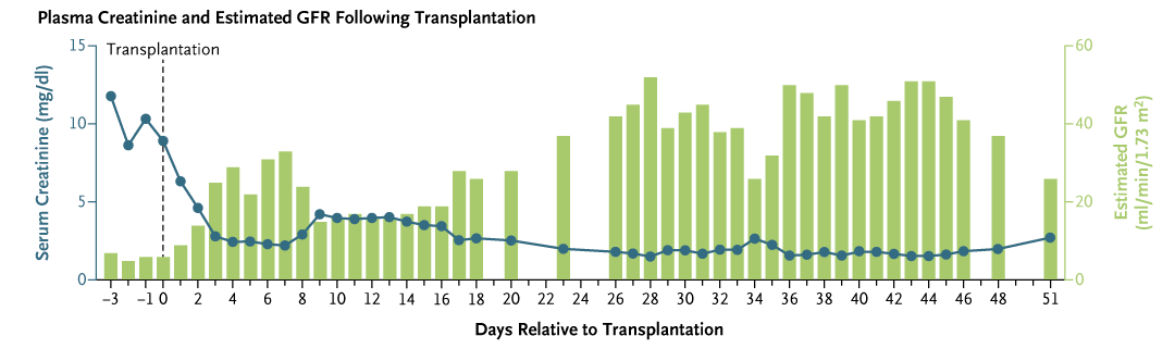 Brief Report: Xenotransplantation of a Porcine Kidney for End-Stage Kidney Disease nej.md/3Esayoz  

Editorial: Xenotransplantation — Long Awaited, Much Learned, Much More to Be Learned nej.md/42WPYqh 

#Surgery #Nephrology