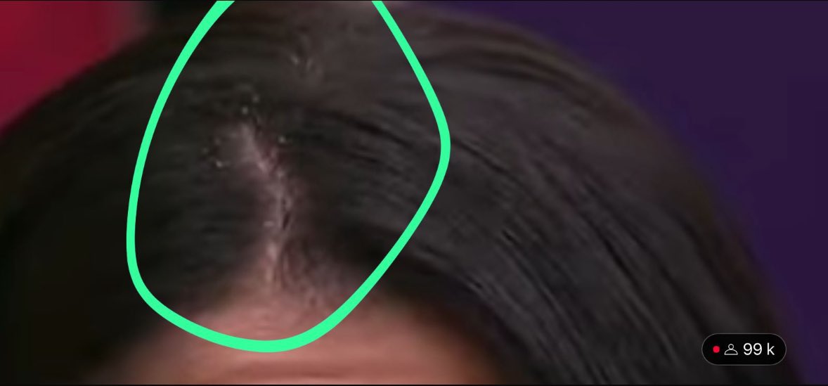 cómo puede haber gente que apoya a la toxicasposa? gas 🤮 #LaCasaDeLosFamososCol #LaCasaDeLosFamososCol2