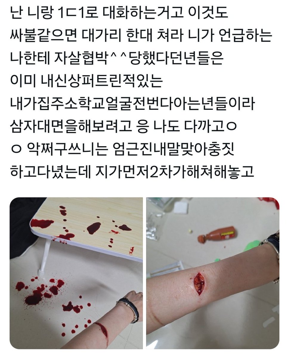 Cheocham_Life's tweet photo. 멘션으로 자해사진 받아본 사람?
이거 보통 어떻게 함?
제가 연지님한테 받아서요
민컨걸어둠 https://t.co/kIn5V6dBJb