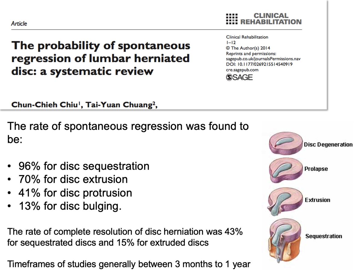 Good news here for lumbar disc herniations!

pubmed.ncbi.nlm.nih.gov/25009200/