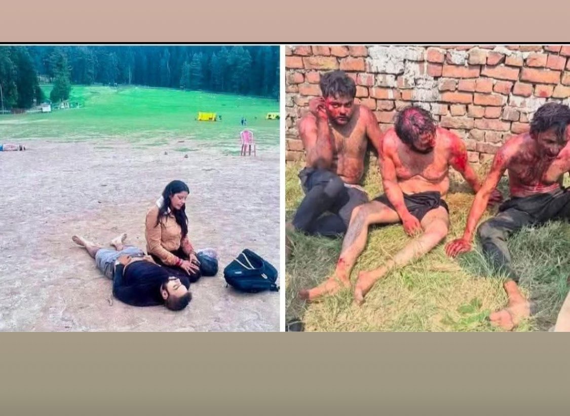 Both have been hurt by terrorists, one by those who came from outside, and the other by those from within the country🥲🥲