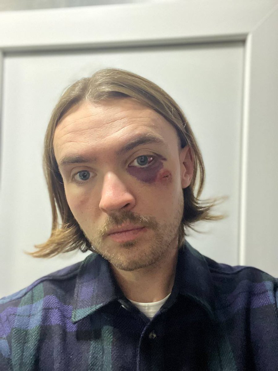 Молодых мам с детьми он убеждает в своей любви, парням обещает решить вопросы с военкоматом. Он убедителен и спокоен, поэтому люди без проблем отдают ему деньги. Даже получив по лицу за обман, он придумывает под это новую невероятную историю для будущих жертв