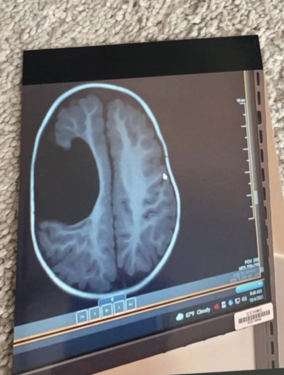 I really don’t think jeans should stretch. 

Also, I just got my MRI results back.