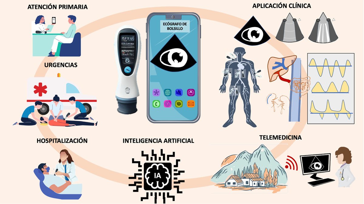 REC Publications (@revespcardiol) on Twitter photo Papel del ecógrafo de bolsillo en la exploración cardiovascular multidisciplinar. Revisión del estado actual #reccardioclinics #Aheadofprint <a href="/SeguraCardio/">Diego Segura-Rodríguez</a> <a href="/BonanadClara/">Clara Bonanad</a> <a href="/rfreixap/">Román Freixa Pamias</a> <a href="/S_Raposeiras/">Sergio Raposeiras-Roubín</a> <a href="/docvivas/">David Vivas</a> reccardioclinics.org/en-papel-del-e… Papel del ecógrafo de bolsillo en la exploración cardiovascular multidisciplinar. Revisión del estado actual #reccardioclinics #Aheadofprint <a href="/SeguraCardio/">Diego Segura-Rodríguez</a> <a href="/BonanadClara/">Clara Bonanad</a> <a href="/rfreixap/">Román Freixa Pamias</a> <a href="/S_Raposeiras/">Sergio Raposeiras-Roubín</a> <a href="/docvivas/">David Vivas</a> reccardioclinics.org/en-papel-del-e…