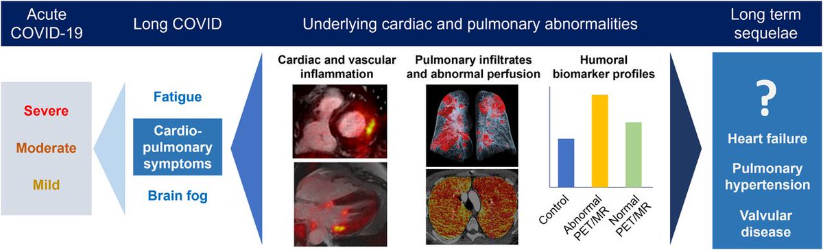 JNM (@journalofnucmed) on Twitter photo Prevalence of persistent cardiovascular and pulmonary abnormalities on PET/MRI and DECT imaging in long COVID patients. ow.ly/U3J350VSPG1
#NuclearMedicine #PETscan #LongCovid <a href="/munirghesani/">Munir Ghesani</a> <a href="/MiriamMerad/">Miriam Merad, MD, PhD</a> Prevalence of persistent cardiovascular and pulmonary abnormalities on PET/MRI and DECT imaging in long COVID patients. ow.ly/U3J350VSPG1
#NuclearMedicine #PETscan #LongCovid <a href="/munirghesani/">Munir Ghesani</a> <a href="/MiriamMerad/">Miriam Merad, MD, PhD</a>
