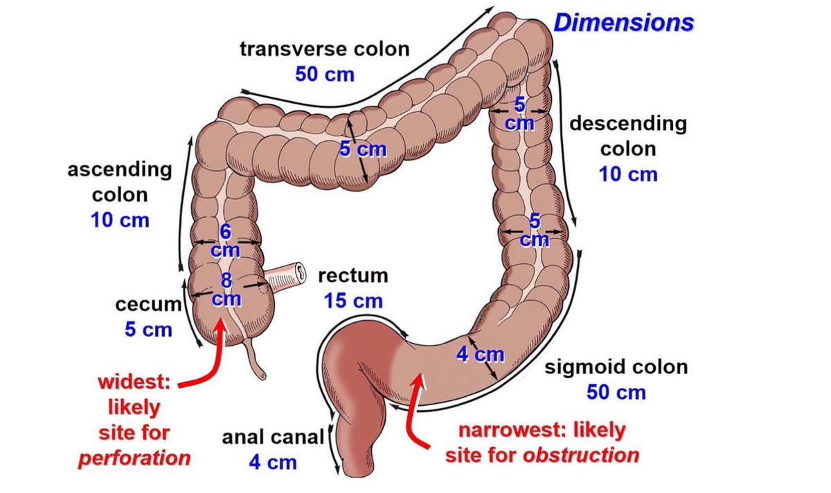 Recordamos la regla 3-6-9 para los diámetros intestinales, más allá del cual existe riesgo de perforación 🚨 

-Intestino delgado: &lt; 3 cm 
-Intestino grueso: &lt; 6 cm 
-Ciego: &lt; 9 cm
