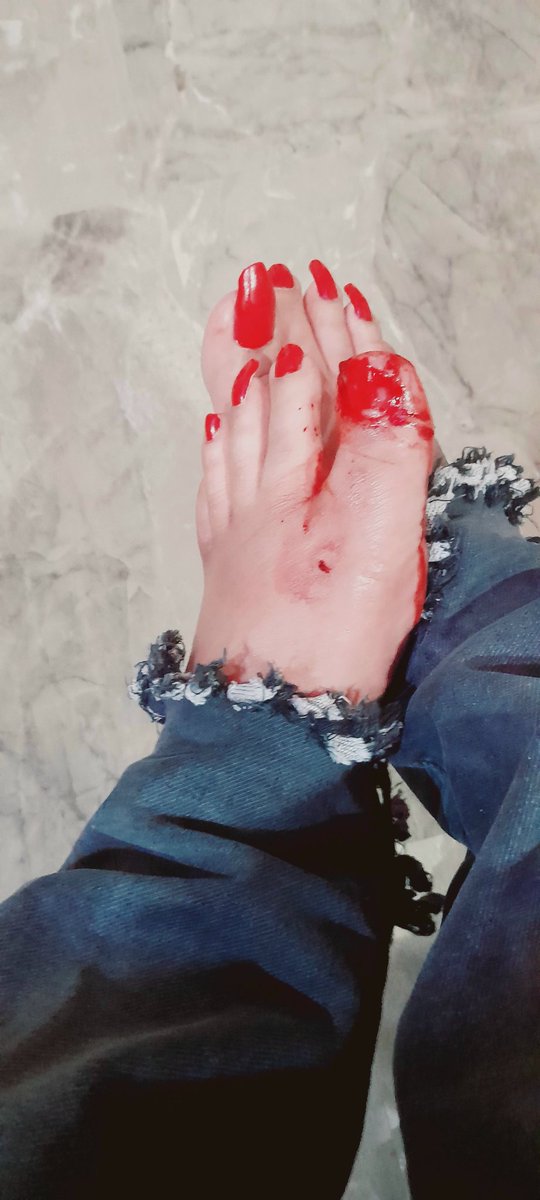 Simi1725814's tweet photo. Nakhuun tut geha mera accident me https://t.co/cacz327CvH