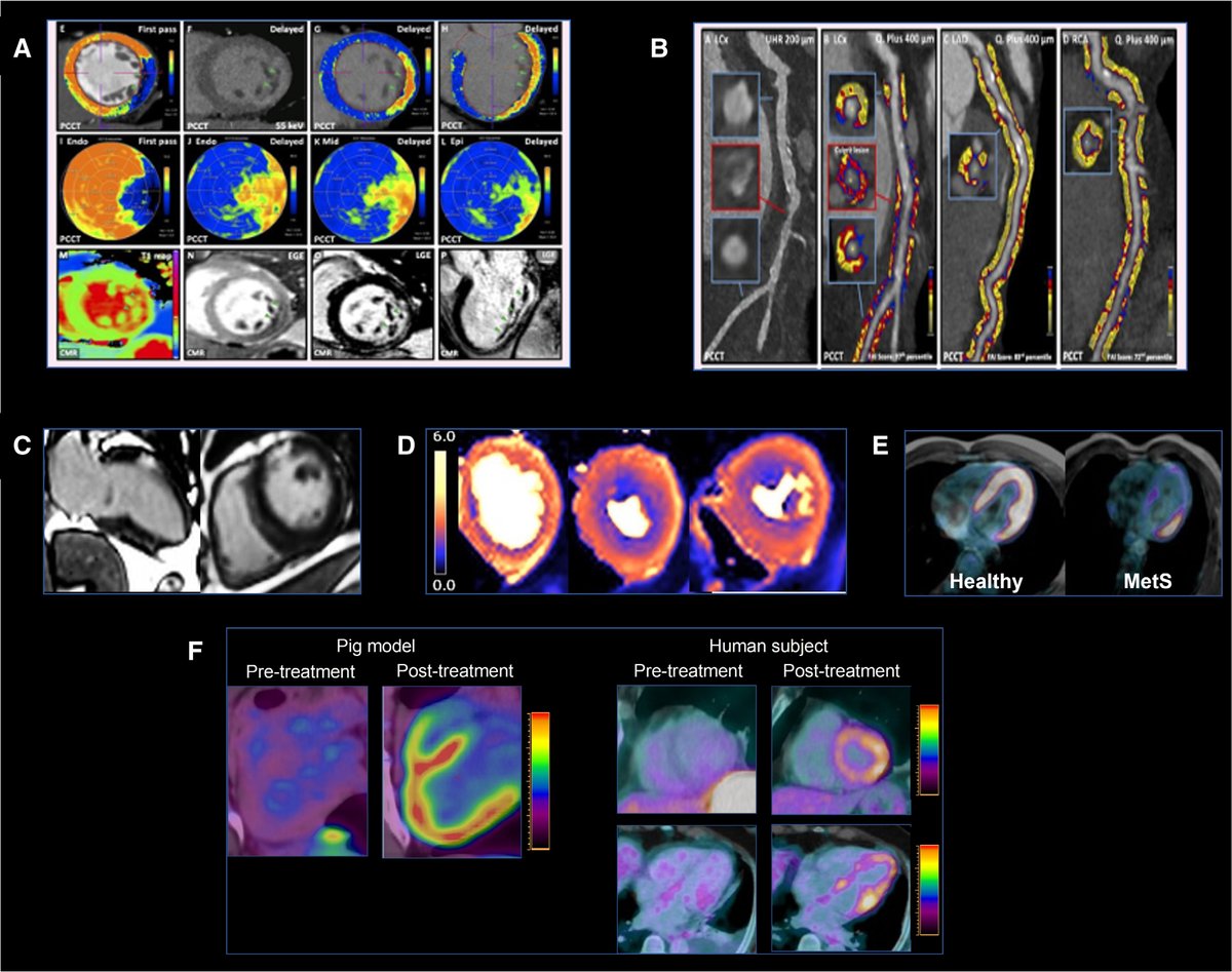 CNIC (@cnic_cardio) on Twitter photo 🔬🫀Una revisión publicada en <a href="/CircAHA/">Circulation</a> y liderada por investigadores del <a href="/CNIC_CARDIO/">CNIC</a> y la <a href="/UniofOxford/">University of Oxford</a> destaca el papel fundamental de las técnicas de imagen avanzada para comprender cómo interactúan el corazón, el hígado, el cerebro y otros órganos en enfermedades como la 🔬🫀Una revisión publicada en <a href="/CircAHA/">Circulation</a> y liderada por investigadores del <a href="/CNIC_CARDIO/">CNIC</a> y la <a href="/UniofOxford/">University of Oxford</a> destaca el papel fundamental de las técnicas de imagen avanzada para comprender cómo interactúan el corazón, el hígado, el cerebro y otros órganos en enfermedades como la
