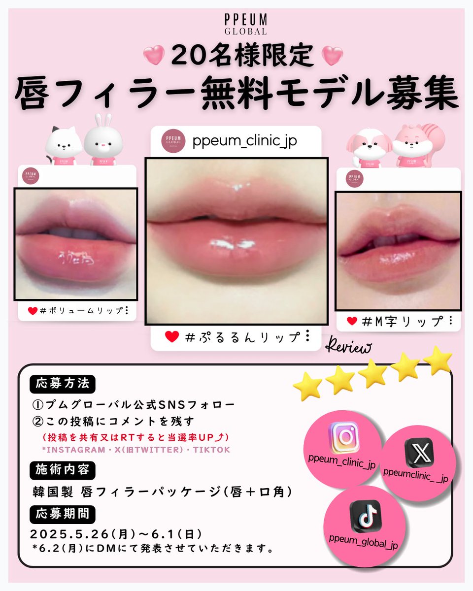 ppeumclinic__jp's tweet photo. 👸🏻唇フィラー無料モデル募集💋

プムグローバルクリニックが
💌唇フィラー無料モデル💌を募集します！

なんと20名様限定募集!!!!!!!
プムグローバルで理想の唇を作りましょう💕

韓国で流行りの唇デザインで魅力的な唇へ💗

✔応募期間 : 5月26日(月)~6月1日(日)
*当選者は6月2日(月)にDMにて発表させて頂きます✨
*当選者のみ

🎀応募条件🎀
①プムグローバル公式SNSをフォローしてくれた方
②この投稿にコメントを残してくれた方
(投稿をRTすると当選率UP)
③ご来院後10日以内にレビュー投稿が可能な方
④当選者発表後、3ヶ月後(9月2日)までご来院可能な方
⑤ビフォーアフター写真の提出・公開が可能な方

🎀プロセス🎀
①プムグローバル公式SNSフォロー＋この投稿にコメントを残す
②当選者をDMにてご報告
③ご来院後10日以内にレビュー投稿
たくさんのご応募をお待ちしております💬

🙂プムグローバル全支店当日予約OK
🍒お問い合わせは公式LINEまで
💕日本語対応のプムグローバル日本公式ラインからご予約可能
📱プムグローバル公式SNSはプロフィールから飛べます！