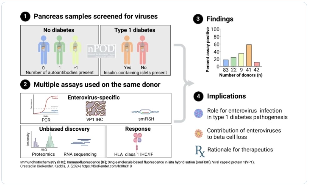 Up front &amp; free to read in our June issue #editorspicks: Joint analysis of the nPOD-Virus Group data: the association of enterovirus with type 1 diabetes is supported by multiple markers of infection in pancreas tissue link.springer.com/article/10.100…