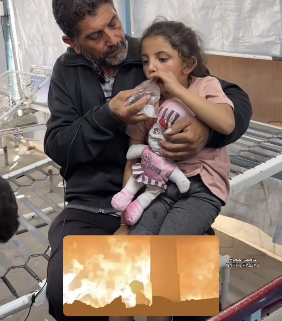 Alhamdulillah !! 💔

The little girl, Ward ..
whom you saw caught in the crossfire and survived in a state of extreme shock, is now receiving treatment. Her entire family was martyred, but she survived.