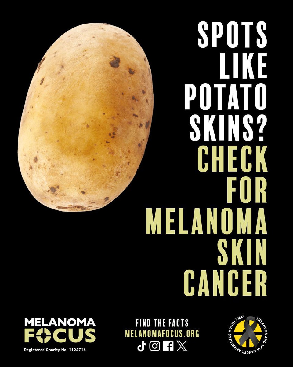 Chartered Institute of Horticulture (@cihort) on Twitter photo This #MelanomaAwarenessMonth <a href="/focusonmelanoma/">Melanoma Focus UK</a> is urging you to #KnowYourSkin
☑️Check your skin & contact your GP if you notice new or changing moles or lesions
☑️Protect your skin from the sun with SPF30+ sunscreen & avoid sunbeds
Find out more: buff.ly/3N8ELve This #MelanomaAwarenessMonth <a href="/focusonmelanoma/">Melanoma Focus UK</a> is urging you to #KnowYourSkin
☑️Check your skin & contact your GP if you notice new or changing moles or lesions
☑️Protect your skin from the sun with SPF30+ sunscreen & avoid sunbeds
Find out more: buff.ly/3N8ELve