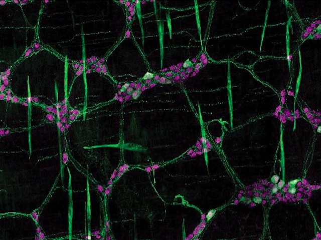 Biomedical Picture of the Day BPoD (@bpod_s) on Twitter photo A novel class of sensory neurons involved in gut movements discovered - marked by protein Cdh6
Image made with <a href="/LeicaMicro/">Leica Microsystems</a> SP8 confocal
📷 Julieta Gomez-Frittelli et al <a href="/StanfordBrain/">Wu Tsai Neurosciences Institute</a> in <a href="/eLife/">eLife - the journal</a>
➡️ bpod.org.uk/archive/2025/5… A novel class of sensory neurons involved in gut movements discovered - marked by protein Cdh6
Image made with <a href="/LeicaMicro/">Leica Microsystems</a> SP8 confocal
📷 Julieta Gomez-Frittelli et al <a href="/StanfordBrain/">Wu Tsai Neurosciences Institute</a> in <a href="/eLife/">eLife - the journal</a>
➡️ bpod.org.uk/archive/2025/5…