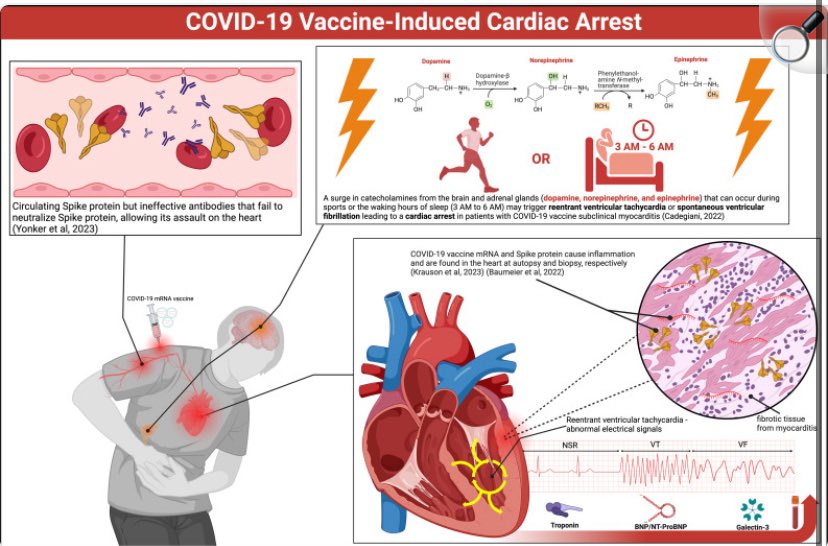 Even the dogs on the street know something’s not right…

When healthy people keep dying “suddenly and unexpectedly”.

If Irish cardiologists won’t speak for fear of backlash…

We’ll listen to those who will. 

Dr. Peter McCullough isn’t whispering — he’s warning.