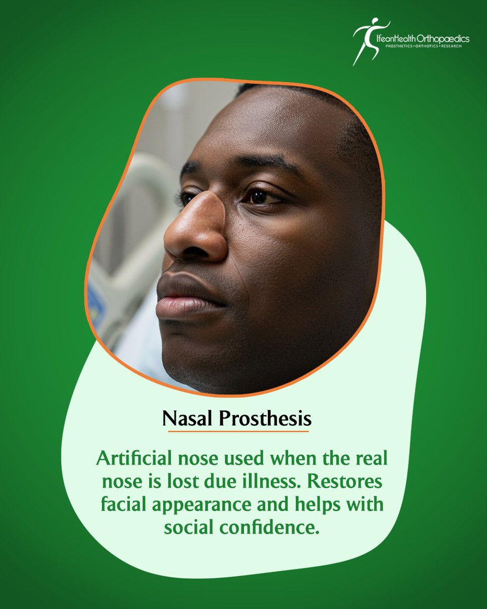ifeanhealthng's tweet image. Prostheses are not just legs and arms. 

There are other types of prosthesis that there are.

You might have known some before now or not.

Like, comment and share.
#IfeanHealth #Prosthesis #BreastProsthesis #EyeProsthesis #DentalProsthesis