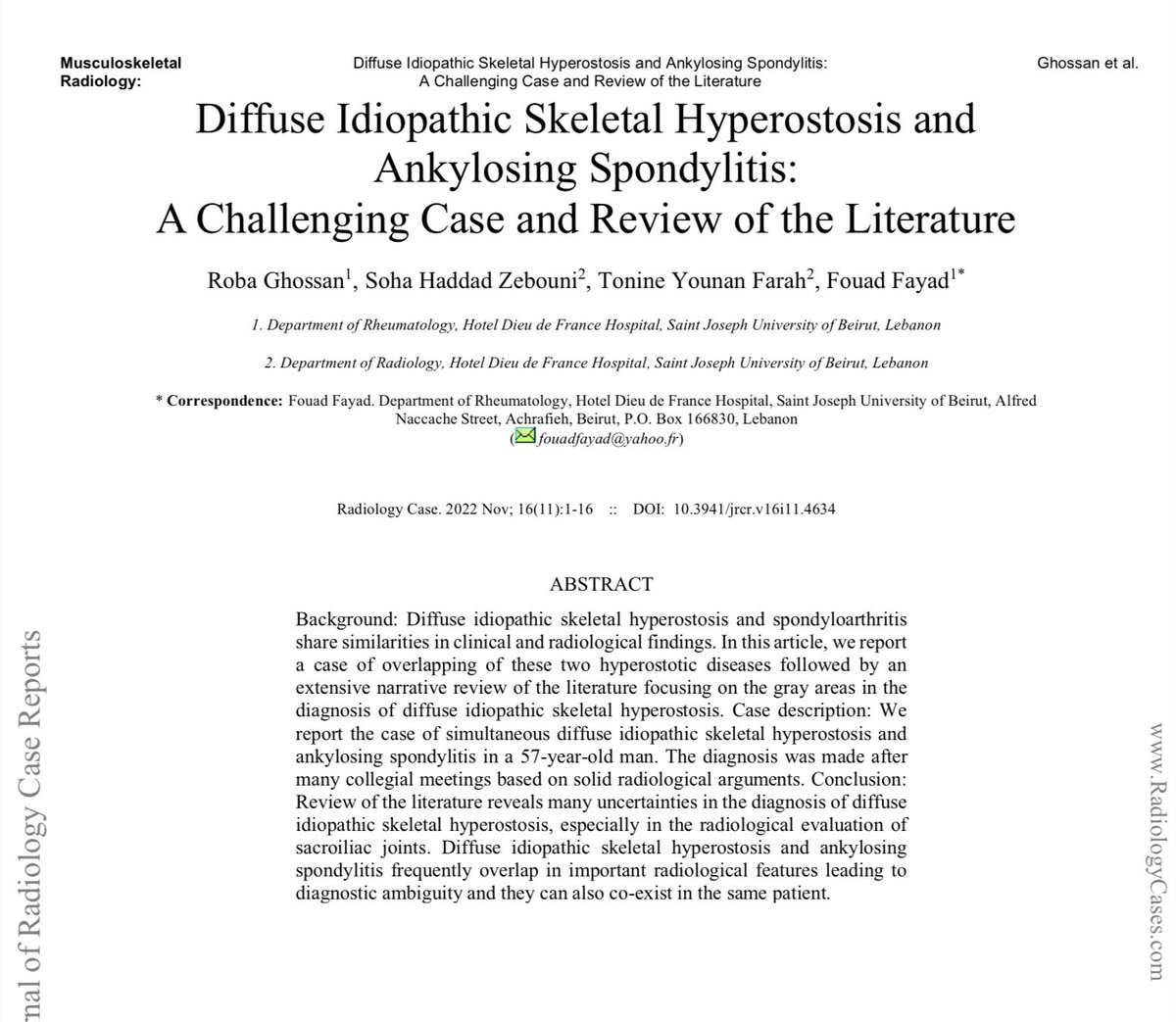 Diffuse Idiopathic Skeletal Hyperostosis and Ankylosing Spondylitis: A Challenging Case and Review of the Literature

pmc.ncbi.nlm.nih.gov/articles/PMC97…