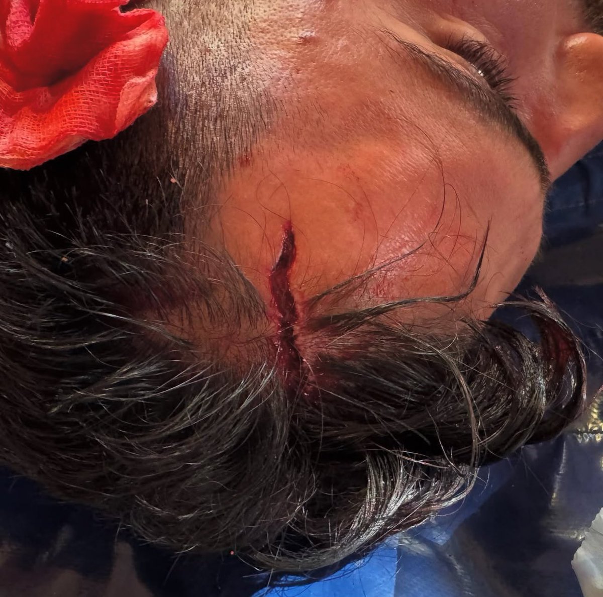 Mais um triste episódio 😢

As melhoras ao Miguel Santos, estas situações têm que ser expostas e tem de ser apresentada queixa. Infelizmente, cada vez mais recorrente.