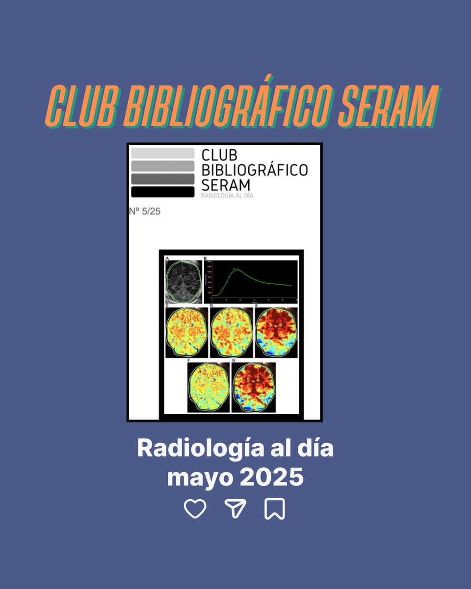 Club bibliog SERAM (@cbseram) on Twitter photo 🔴EXTRA EXTRA🔴
☢️📷 ¡Ya disponible el número de #mayo del CBSERAM! ☢️📷
➡️En el siguiente enlace puedes acceder al número en PDF📖:
cbseram.com/wp-content/upl…
➡️Editorial por Fernando Luis Begliardo
<a href="/SERAM_RX/">SERAM - Sociedad Española de Radiología Médica</a>
<a href="/residentesSERAM/">Residentes SERAM</a> 🔴EXTRA EXTRA🔴
☢️📷 ¡Ya disponible el número de #mayo del CBSERAM! ☢️📷
➡️En el siguiente enlace puedes acceder al número en PDF📖:
cbseram.com/wp-content/upl…
➡️Editorial por Fernando Luis Begliardo
<a href="/SERAM_RX/">SERAM - Sociedad Española de Radiología Médica</a>
<a href="/residentesSERAM/">Residentes SERAM</a>