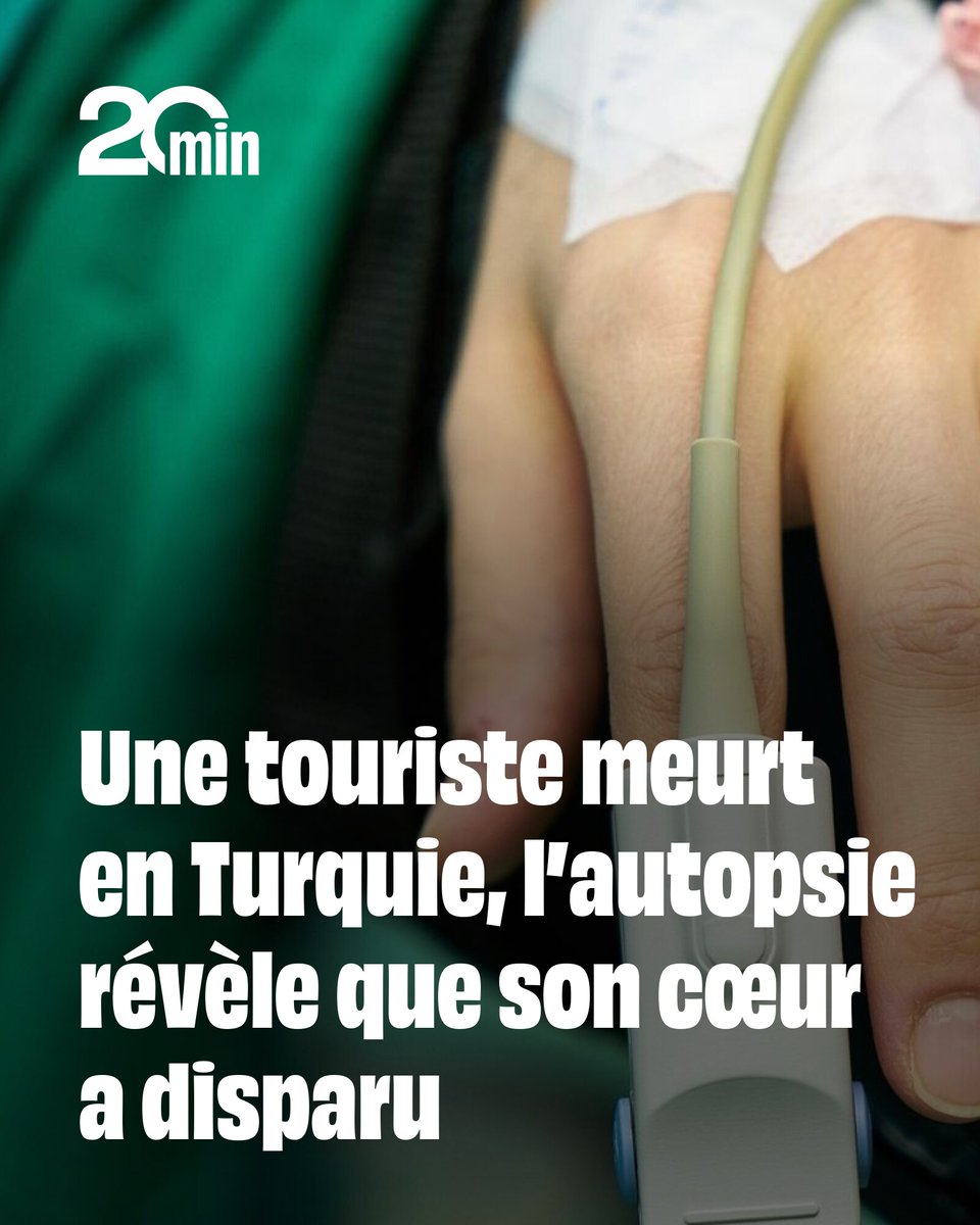 20Minutes's tweet photo. Une touriste meurt en Turquie, l’autopsie révèle que son cœur a disparu
➡️ https://t.co/hD7h90w31V https://t.co/WQDAOKAvyo
