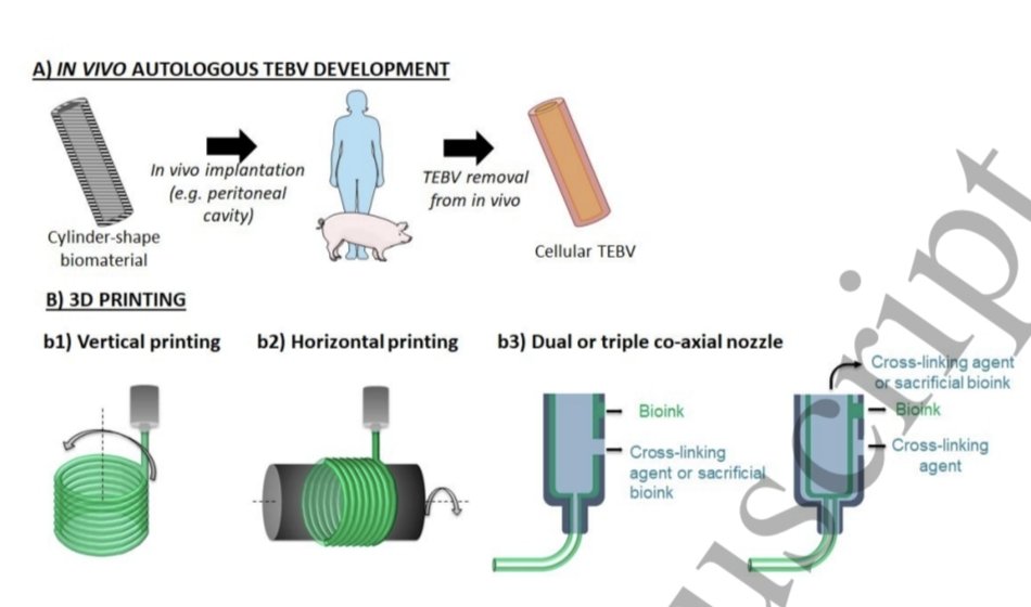 jcrivasferr's tweet image. Could #tissue #Engineering of #blood #vessels eliminate the use of #saphenous #veins and #LIMA in future #bypass #surgeries? 🔬🐁🧬

If #fibroblasts from a patient with vascular disease can be extracted and reprogrammed into in vitro #pluripotent #stem #cells (#iPSCs), then