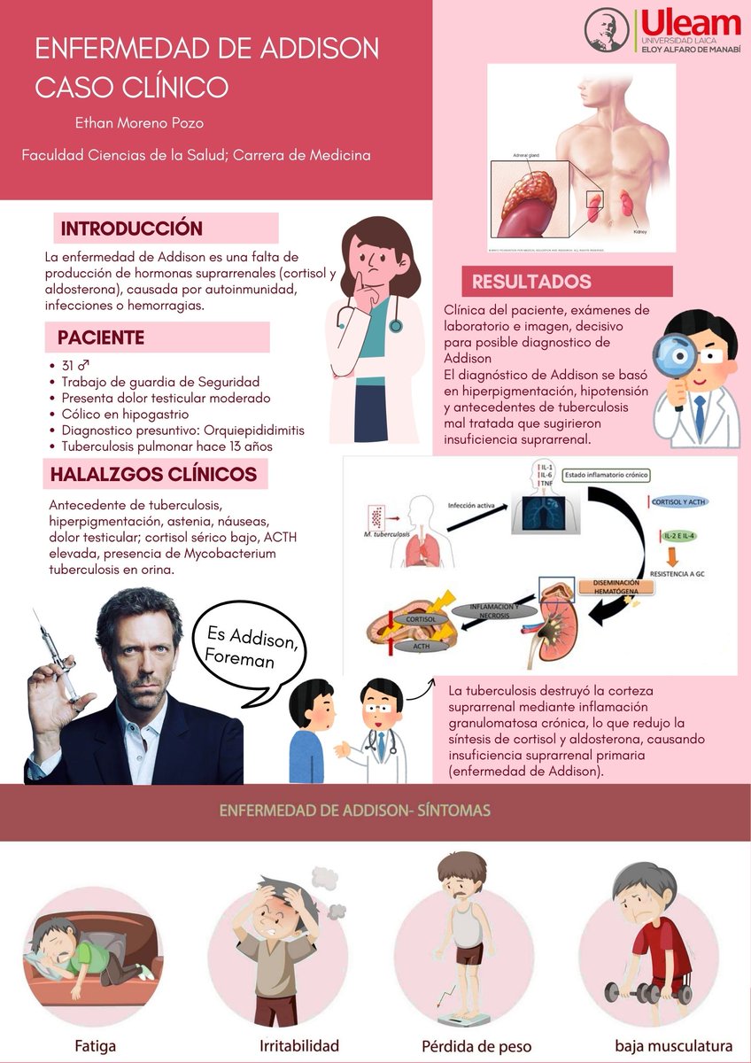 ElPepMP's tweet photo. 🧬 La enfermedad de Addison puede ser consecuencia de infecciones como la tuberculosis. 

🏥 Este caso clínico muestra cómo una insuficiencia suprarrenal primaria puede pasar desapercibida sin un abordaje integral.

#UleamEsAcademia #UleamEnBuenasManos @Anghelo77ac @UleamEcuador https://t.co/IMxznvGmRd