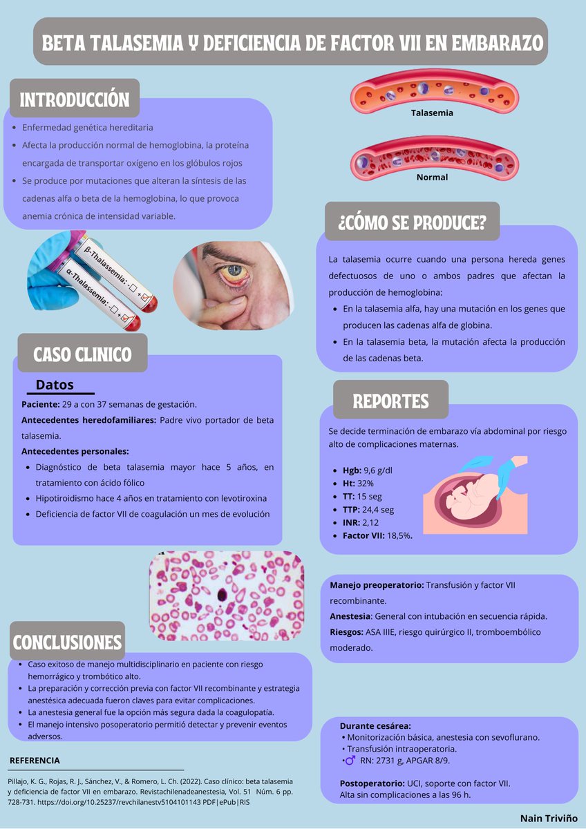 jordyortegoo's tweet photo. 📌 Beta talasemia y deficiencia de factor VII en el embarazo
Presentación de un caso clínico complejo con manejo multidisciplinario exitoso en paciente con alto riesgo hemorrágico.
🩸🤰👩‍⚕️
Más detalles en el póster 👇
#UleamEsAdemia #UleamEnBuenasManos
@Anghelo77ac 
#UleamEcuador https://t.co/JX0cA3Jw0s